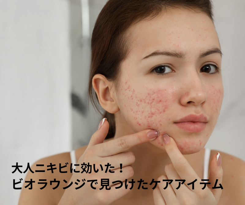 大人ニキビに効いた！オーガニックケアアイテム